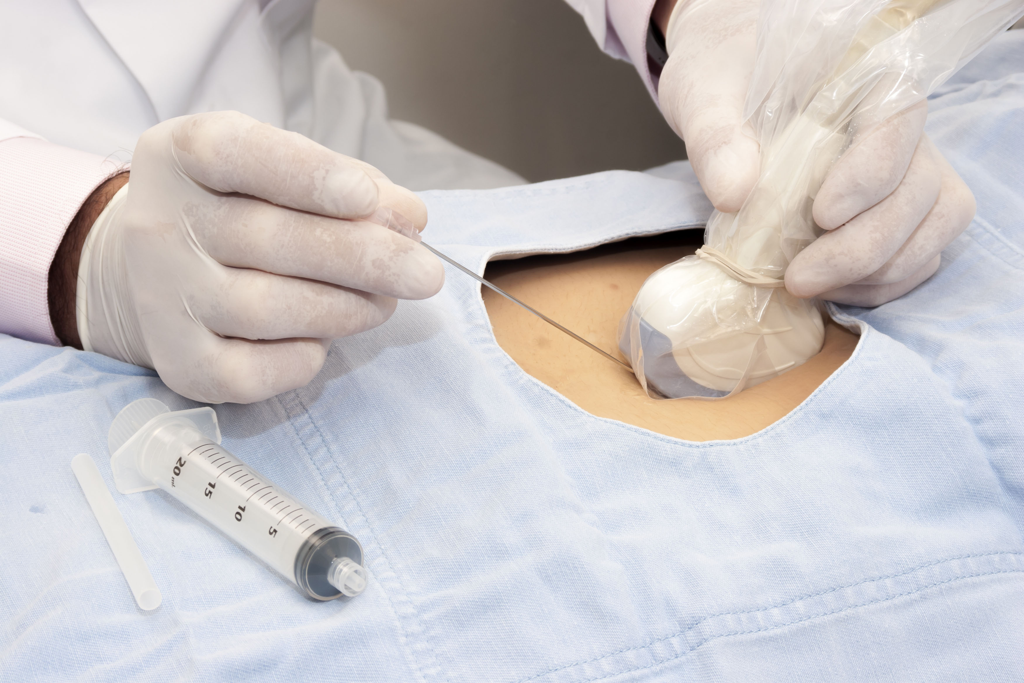Sterilisation